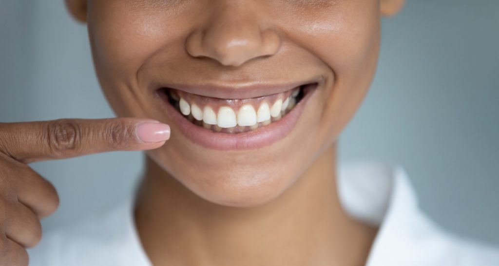 A woman pointing to her bright white smile.