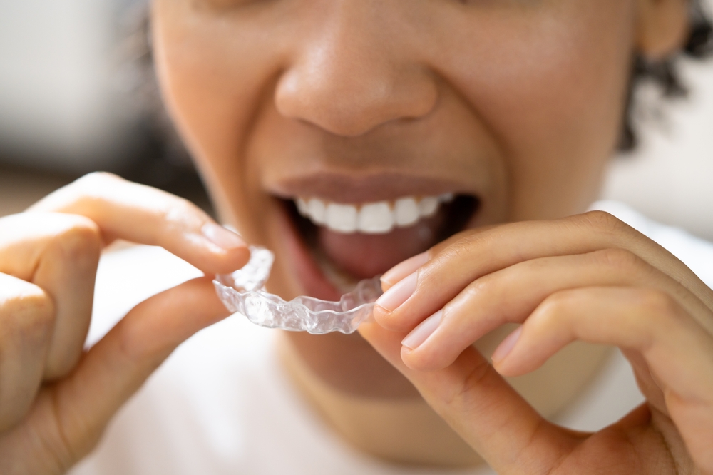 woman putting a night guard in her mouth