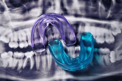 Mouth,Guards,On,Dental,Scan,,Flat,Lay.,Bite,Correction